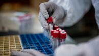 Covid-19: apesar de alta de casos, número de óbitos continua em queda no Brasil