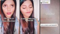 Influencer conta que doou rim para o namorado e, após operação, descobriu que ele era casado