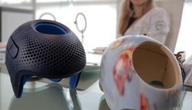 Bebê com cabeça achatada é normal? Entenda o que é plagiocefalia posicional e saiba como prevenir