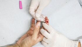 Homens são maioria dos casos e óbitos por HIV/Aids no Recife, aponta levantamento da Sesau