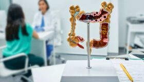 Prevenção ao câncer de intestino requer estilo de vida saudável