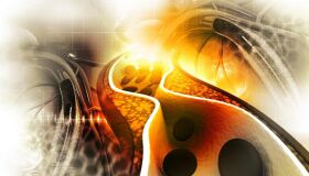 O papel do exercício físico na gestão dos níveis de colesterol e na saúde cardiovascular