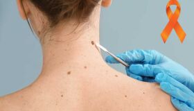 Dezembro Laranja ilumina a conscientização e prevenção do Câncer de Pele