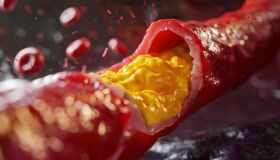 Colesterol: mudança de hábitos pode controlar taxa