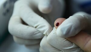 Pernambuco notifica mais dois casos de hepatite aguda grave de origem desconhecida