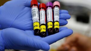 Brasil tem, nesta sexta (18), o segundo maior registro diário de novos casos da Covid-19