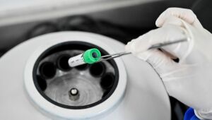 Pernambuco registra 1.714 novos casos e 19 mortes nas últimas 24h