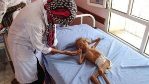 Programa Mundial de Alimentos alerta para situação 'extremamente grave' no Iêmen