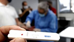 Pernambuco notifica mais 1.021 casos da Covid-19, além de 21 mortes