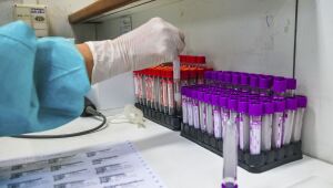 Governo federal adota precaução e teme corrida de estados por vacina russa