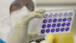 Fabricante de anticorpos sintéticos contra a Covid-19 publica resultados positivos
