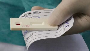 Pernambuco registra, nesta sexta (1ª), três mortes e 2.961 novos casos de Covid-19