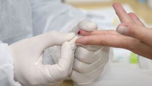 Pernambuco registra 1.393 casos da Covid-19 e 41 mortes nas últimas 24h