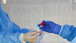 Pesquisa comprova que Covid-19 é também doença vascular