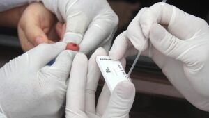 Pernambuco registra 80 novos casos da Covid-19 e 16 mortes nas últimas 24h