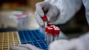 Imunidade contra a Covid-19 pode ser maior que seis meses, afirma estudo