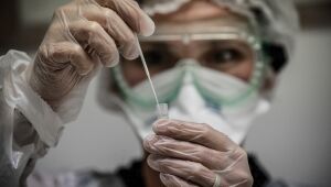 Pernambuco registra 157 novos casos e 10 óbitos nas últimas 24h