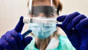 Brasil atinge 5,4 milhões de casos da Covid-19