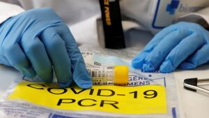 Pernambuco registra 781 casos da Covid-19 nas últimas 24h e 25 novas mortes