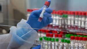 Pernambuco confirma 1.038 novos casos e 34 mortes pela Covid-19