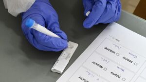 Covid-19: Brasil tem 6 milhões de casos e quase 170 mil mortes