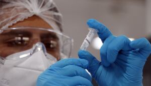 Pernambuco registra 1.652 novos casos e 25 novas mortes pela Covid-19 em 24h