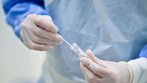 Brasil completa um ano do primeiro caso de Covid na contramão do mundo