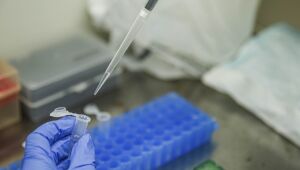 Pernambuco notifica 1.635 novos casos de Covid-19 e 28 mortes