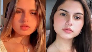 Gêmeas trans brasileiras passam juntas por cirurgia de redesignação sexual