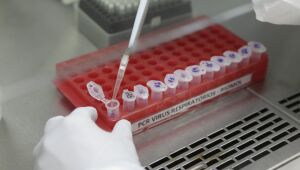 Pernambuco registra 964 novos casos da Covid-19 e 38 mortes