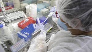Pernambuco já realizou 2 milhões de exames para detecção da Covid-19
