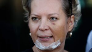 Em depoimento sobre ferimentos, Joice Hasselmann critica Heleno e diz não confiar na PF