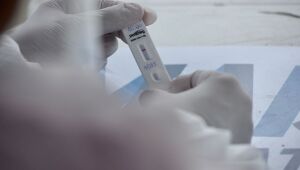 Pernambuco registra três mortes e 283 novos casos de Covid-19 nas últimas 24h