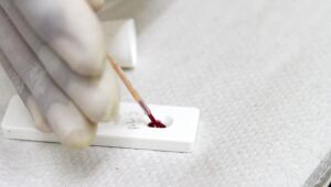 Jaboatão dos Guararapes realiza testagem de HIV e hepatites no Dia Mundial da Aids