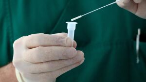 Covid-19: Brasil registra 40,6 mil casos e 139 mortes em 24 horas