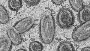 Epidemiologista acredita que ainda 'é cedo' para falar de epidemia de varíola dos macacos