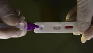 Pernambuco registra, neste domingo (26), quatro mortes e 545 novos casos de Covid-19