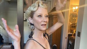 Atriz Anne Heche está intubada e estável após grave acidente de carro nos EUA