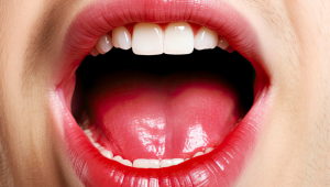 Mau hálito: conheça soluções científicas para combater problema