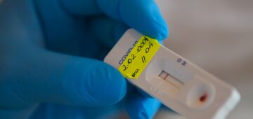 Pernambuco registra 553 novos casos e 16 mortes por Covid-19, nas últimas 24 horas