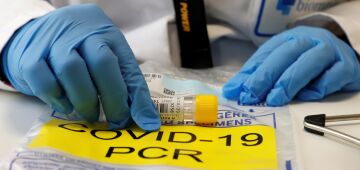 Pernambuco registra 781 casos da Covid-19 nas últimas 24h e 25 novas mortes