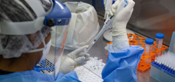 Aumento de casos de SRAG no Brasil decorrem do rinovírus e Sars-CoV-2