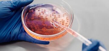 Após depilar região íntima, professor quase morre com infecção bacteriana; entenda o caso