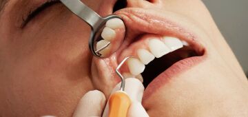 Tratar canal no dente pode melhorar a saúde geral, revela novo estudo