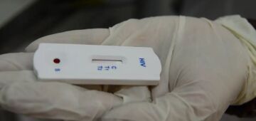 Laboratório interditado: kit de exame que detecta HIV custa apenas R$ 14,59