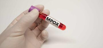 Como a mpox se espalha e quem corre mais risco?