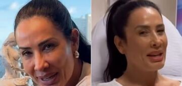 Antes e depois: o efeito do novo tratamento para naturalizar o rosto de Scheila Carvalho