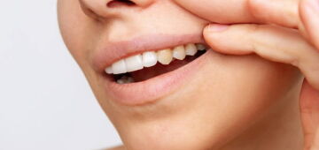 Sorriso amarelo? Entenda o que fazer para manter os dentes brancos