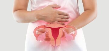 Endometriose: como identificar e tratar