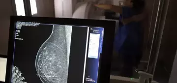Falta de acesso a mamógrafos limita prevenção do câncer de mama